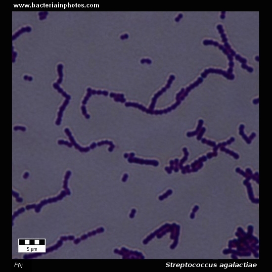 Streptococcus Agalactiae Under Microscope, Group B Streptococcus Or GBS ...